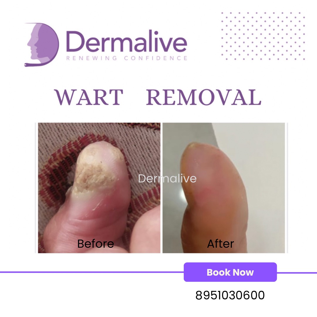 Beauty Care Before After